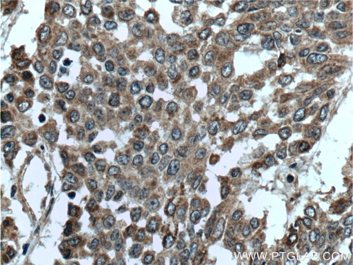 [26294-1-AP-20UL] DALRD3 Polyclonal antibody