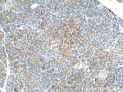 [26295-1-AP-150UL] YRDC Polyclonal antibody