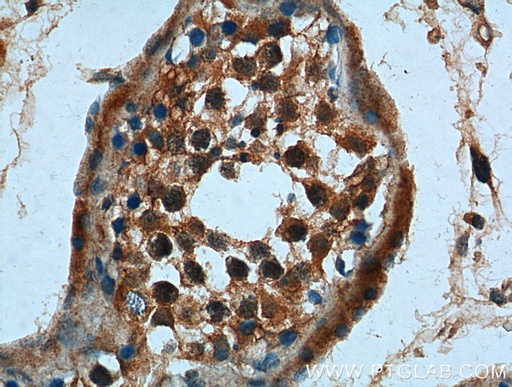 [26301-1-AP-150UL] CCDC68 Polyclonal antibody