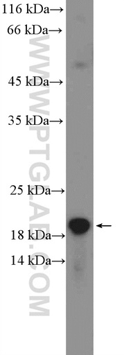 [26304-1-AP-20UL] C1orf93 Polyclonal antibody