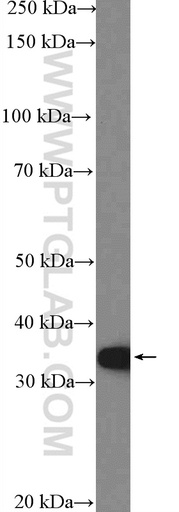 [26312-1-AP-150UL] MCU/CCDC109A Polyclonal antibody