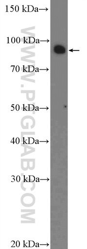 [26314-1-AP-20UL] CCDC21 Polyclonal antibody