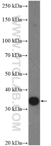 [26318-1-AP-20UL] C15orf38 Polyclonal antibody