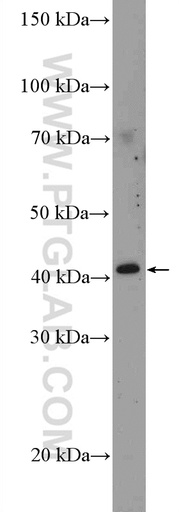 [26321-1-AP-150UL] C10orf46 Polyclonal antibody