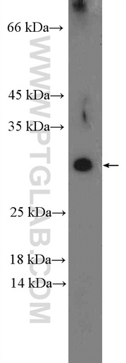 [26327-1-AP-150UL] DYDC1 Polyclonal antibody