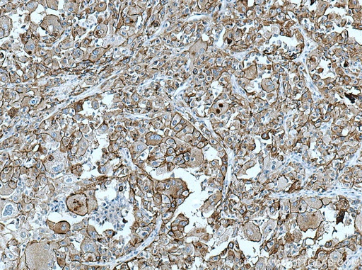 [26332-1-AP-20UL] AE2 Polyclonal antibody