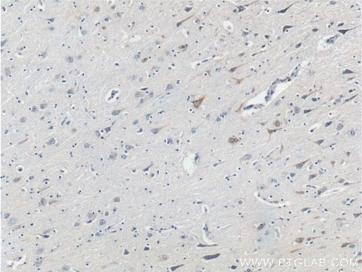 [26351-1-AP-20UL] Neurofascin Polyclonal antibody