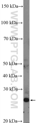[26355-1-AP-150UL] FLJ14213 Polyclonal antibody