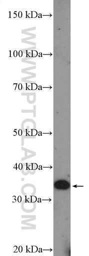[26356-1-AP-150UL] DCUN1D3 Polyclonal antibody
