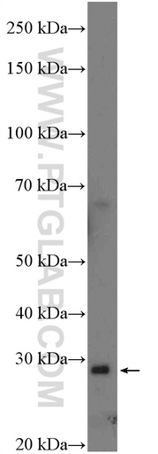 [26359-1-AP-150UL] C20orf7 Polyclonal antibody