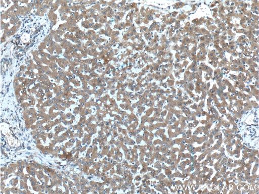 [26366-1-AP-150UL] F2R Polyclonal antibody