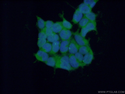 [26368-1-AP-150UL] RNF14 Polyclonal antibody