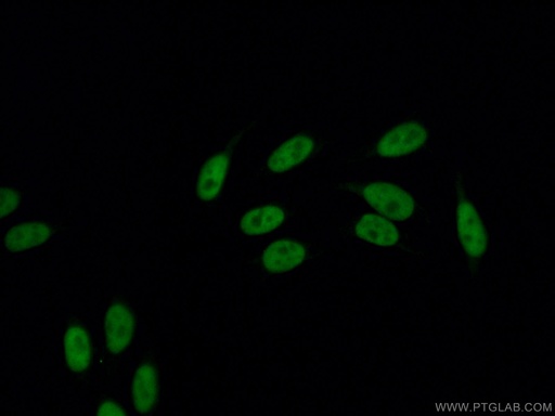 [26385-1-AP-20UL] DDX5 Polyclonal antibody