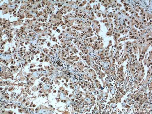 [26387-1-AP-150UL] CCDC59 Polyclonal antibody