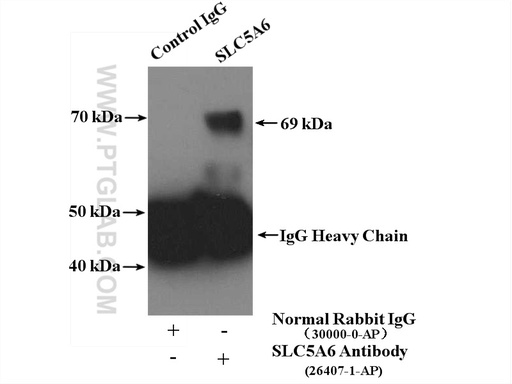 [26407-1-AP-20UL] SLC5A6 Polyclonal antibody