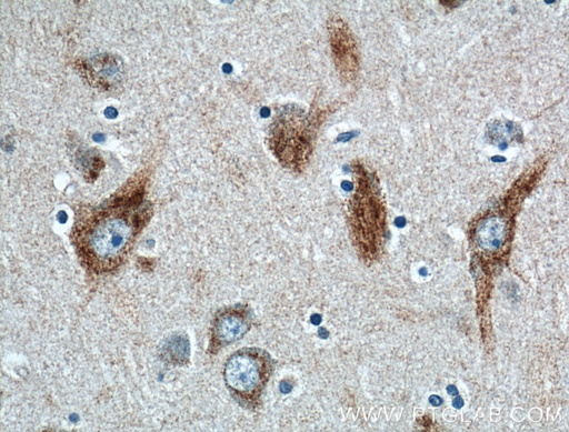 [26408-1-AP-150UL] HTR2B Polyclonal antibody
