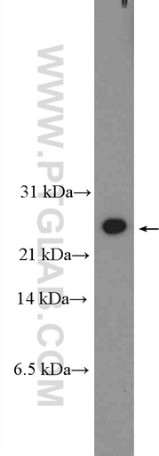[26409-1-AP-150UL] C16orf63 Polyclonal antibody