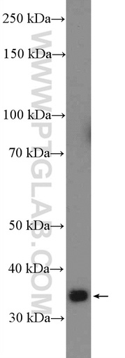 [26413-1-AP-20UL] FAM92B Polyclonal antibody