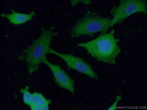 [26421-1-AP-20UL] ENAH Polyclonal antibody