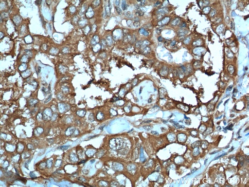 [26424-1-AP-20UL] LHCGR Polyclonal antibody