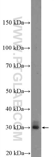[26440-1-AP-20UL] Enkurin Polyclonal antibody