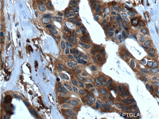 [26447-1-AP-20UL] SRMS Polyclonal antibody