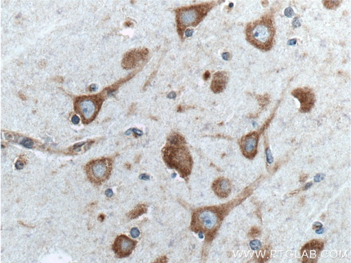 [26449-1-AP-150UL] NME7 Polyclonal antibody