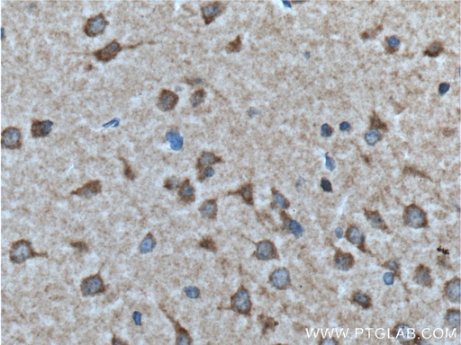 [26459-1-AP-20UL] GALR2 Polyclonal antibody