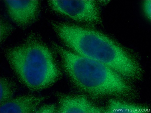 [26460-1-AP-150UL] SFRP1 Polyclonal antibody