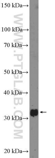 [26464-1-AP-20UL] cyclin C Polyclonal antibody