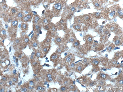 [26469-1-AP-20UL] Mitoferrin 1 Polyclonal antibody