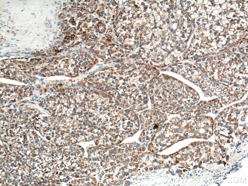 [26470-1-AP-150UL] OTC Polyclonal antibody