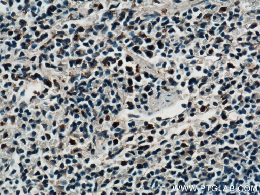 [26474-1-AP-150UL] SPC25 Polyclonal antibody