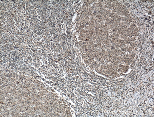 [26477-1-AP-20UL] CD62L Polyclonal antibody