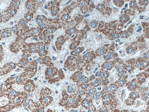 [26486-1-AP-150UL] SLC2A9 Polyclonal antibody