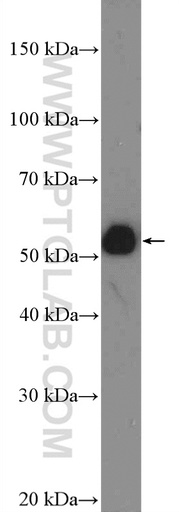[26497-1-AP-20UL] HOXA10 Polyclonal antibody
