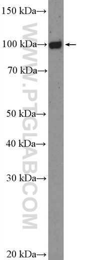 [26503-1-AP-20UL] FCRL5 Polyclonal antibody