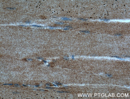 [26513-1-AP-20UL] DIO2 Polyclonal antibody
