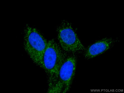 [26519-1-AP-20UL] SDHD Polyclonal antibody