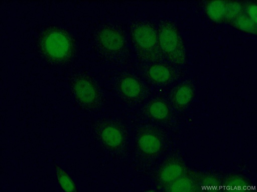 [26532-1-AP-150UL] PPM1D Polyclonal antibody