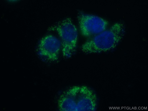 [26536-1-AP-150UL] PMPCA Polyclonal antibody