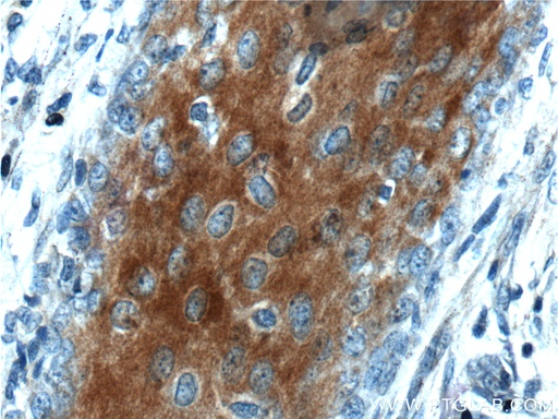 [26541-1-AP-150UL] XYLB Polyclonal antibody