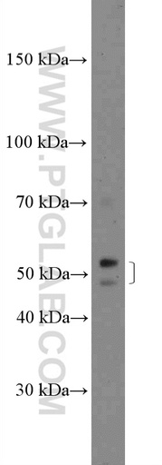 [26545-1-AP-20UL] ZDHHC1 Polyclonal antibody