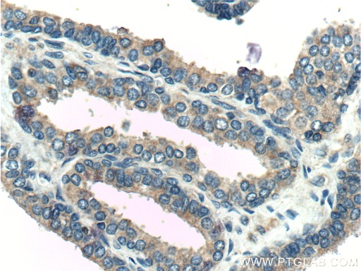 [26547-1-AP-20UL] KLK4 Polyclonal antibody
