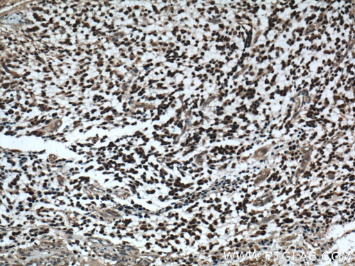 [26551-1-AP-20UL] Phospholipase C Beta 1 Polyclonal antibody
