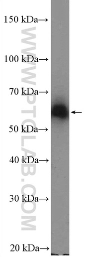 [26560-1-AP-20UL] ZNF382 Polyclonal antibody