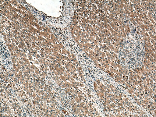 [26562-1-AP-20UL] ATG101 Polyclonal antibody