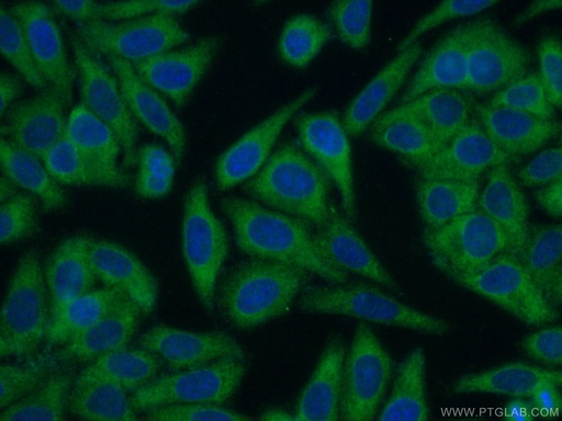 [26570-1-AP-20UL] EHHADH Polyclonal antibody