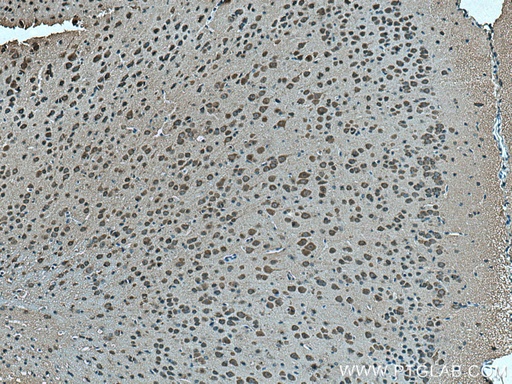 [26574-1-AP-20UL] OAT1 Polyclonal antibody