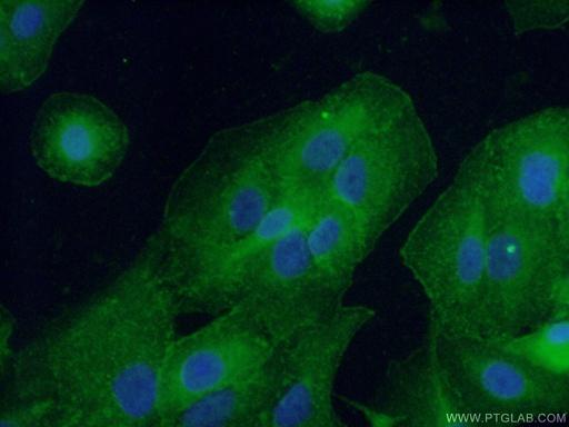 [26580-1-AP-20UL] CD55 Polyclonal antibody